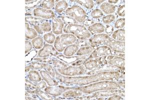 Immunohistochemistry of paraffin-embedded mouse kidney using SNRPD1 Rabbit pAb (ABIN7270363) at dilution of 1:50 (40x lens). (SNRPD1 anticorps  (AA 1-100))