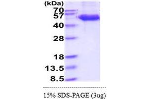 SDS-PAGE (SDS) image for Killer Cell Lectin-Like Receptor Subfamily K, Member 1 (KLRK1) (AA 73-216) protein (hIgG-His-tag) (ABIN7281286)