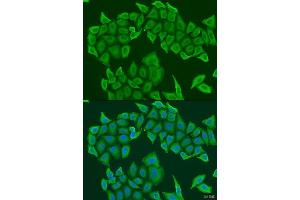 Immunofluorescence analysis of U2OS cells using HAUS8 antibody. (NYS48/HAUS8 anticorps  (AA 166-410))