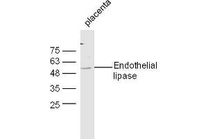 Mouse placenta lysates probed with Anti-Endothelial lipase Polyclonal Antibody, Unconjugated  at 1:5000 90min in 37˚C. (LIPG anticorps  (AA 301-400))