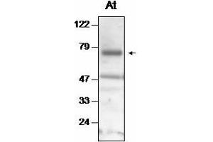 Western blot analysis of Arabidopsis thaliana thylakoid proteins with anti-Deg2 (Deg2 anticorps)