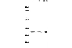 Formalin-fixed and paraffin embedded rat colitis tissue labeled with Anti-IL-1 Beta/IL-1B Polyclonal Antibody, Unconjugated (ABIN872644) at 1:200, followed by conjugation to the secondary antibody and DAB staining