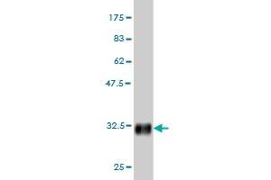 Western Blot detection against Immunogen (31.