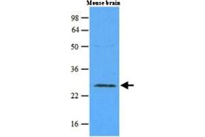 Western blot analysis of mouse brain extracts (45 ug) were resolved by SDS - PAGE , transferred to NC membrane and probed with RAB5A monoclonal antibody , clone 3A4 (1 : 500) . (RAB5 anticorps)