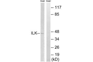 Western blot analysis of extracts from rat liver cells, using ILK (epitope around residue 246) antibody. (ILK anticorps  (Ser246))
