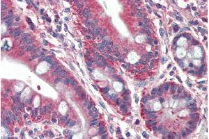 ABIN571280 (5µg/ml) staining of paraffin embedded Human Small Intestine.