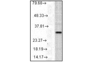 VAlidation of Detection Antibody: Western blot analysis of    HO-1 in a human cell line mix showing specificity at    ~32kDa (HMOX1 Kit ELISA)
