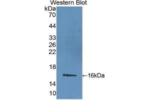 Detection of Recombinant LIMCH1, Mouse using Polyclonal Antibody to LIM And Calponin Homology Domains Containing Protein 1 (LIMCH1) (LIMCH1 anticorps  (AA 21-125))