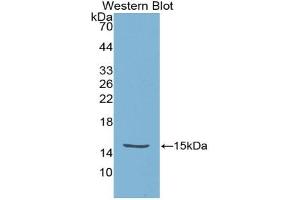Western blot analysis of the recombinant protein. (HTRA1 anticorps  (AA 304-442))
