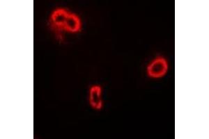 Immunofluorescent analysis of FRZB staining in A549 cells. (FRZB anticorps)