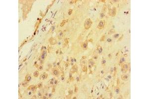 Immunohistochemistry of paraffin-embedded human placenta tissue using ABIN7168949 at dilution of 1:100 (Seryl-tRNA Synthetase (SARS) (AA 2-233) anticorps)