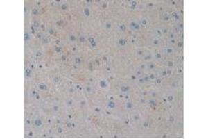 IHC-P analysis of Human Liver Tissue, with DAB staining. (CCK8 anticorps)