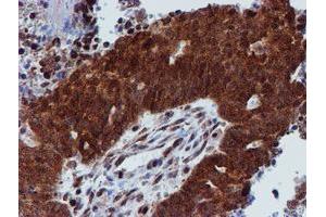 Image no. 5 for anti-Proteasome (Prosome, Macropain) 26S Subunit, Non-ATPase, 2 (PSMD2) antibody (ABIN1500479)