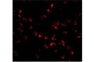 Immunofluorescence of ARF-BP1 in Daudi cells with AP30078PU-N ARF-BP1 antibody at 20 μg/ml. (HUWE1 anticorps  (C-Term))