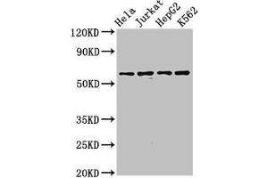 Western Blot Positive WB detected in: Hela whole cell lysate, Jurkat whole cell lysate, HepG2 whole cell lysate, K562 whole cell lysate All lanes: SMARCD1 antibody at 3. (SMARCD1 anticorps  (AA 7-124))