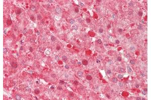 Rabbit Anti-TXN2 antibody Catalog Number: ARP54910 Formalin Fixed Paraffin Embedded Tissue: Human Liver Primary antibody Concentration: 1:200 Secondary Antibody: Donkey anti-Rabbit-Cy3 Secondary Antibody Concentration: 1:200 Magnification: 20x Exposure Time: 0.