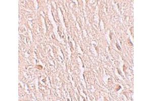 Immunohistochemistry (IHC) image for anti-Leucine Rich Repeat Transmembrane Neuronal 3 (LRRTM3) (C-Term) antibody (ABIN1030498) (LRRTM3 anticorps  (C-Term))