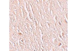 Immunohistochemistry (IHC) image for anti-Leucine Rich Repeat Transmembrane Neuronal 3 (LRRTM3) (C-Term) antibody (ABIN1030498) (LRRTM3 anticorps  (C-Term))