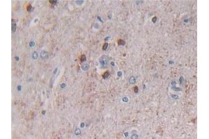 Detection of BECN1 in Human Cerebrum Tissue using Polyclonal Antibody to Beclin 1 (BECN1) (Beclin 1 anticorps  (AA 1-273))