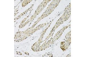 Immunohistochemistry of paraffin-embedded human smooth muscle using CD9 Rabbit pAb  at dilution of 1:100 (40x lens). (CD9 anticorps  (AA 112-195))