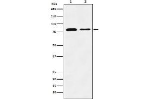 Western blot analysis of LIMPII expression in (1) HeLa cell lysate, (2) Mouse liver lysate.