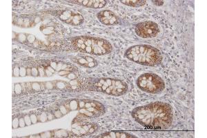 Immunoperoxidase of purified MaxPab antibody to TFAM on formalin-fixed paraffin-embedded human small Intestine.