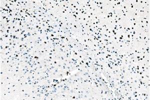 IHC analysis of ADAR1/ADAR using anti-ADAR1/ADAR antibody (ABIN7598956). (ADAR anticorps  (AA 1-1152))