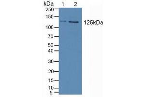 Figure. (JAK2 anticorps  (AA 508-800))