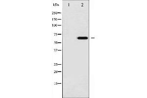 Western blot analysis of Ezrin phosphorylation expression in UV treated 293 whole cell lysates,The lane on the left is treated with the antigen-specific peptide. (Ezrin anticorps  (pTyr146))