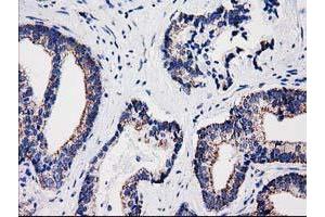 Image no. 1 for anti-Sulfotransferase Family, Cytosolic, 1A, Phenol-Preferring, Member 1 (SULT1A1) antibody (ABIN1501226)