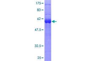 Image no. 1 for Sprouty Homolog 1, Antagonist of FGF Signaling (SPRY1) (AA 1-319) protein (GST tag) (ABIN1321259)