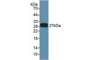 Detection of Recombinant FGF21, Rat using Polyclonal Antibody to Fibroblast Growth Factor 21 (FGF21) (FGF21 anticorps  (AA 25-208))