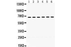 Western Blotting (WB) image for anti-Endogenous Retrovirus Group 3, Member 1 (ERV3-1) (AA 575-604), (C-Term) antibody (ABIN3042376)