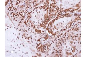 IHC-P Image Immunohistochemical analysis of paraffin-embedded Cal27 Xenograft , using DDB1, antibody at 1:500 dilution. (DDB1 anticorps  (C-Term))