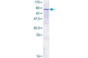 Image no. 1 for Anthrax Toxin Receptor 2 (ANTXR2) (AA 1-488) protein (GST tag) (ABIN1345163)