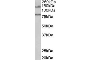 ABIN238631 (1µg/ml) staining of Human Brain (Hippocampus) lysate (35µg protein in RIPA buffer). (EPB41L5 anticorps  (Internal Region))