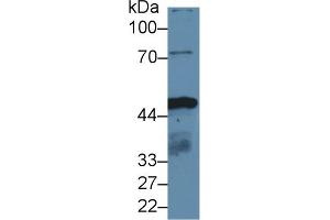 Detection of IDH1 in Human HepG2 cell lysate using Polyclonal Antibody to Isocitrate Dehydrogenase 1, Soluble (IDH1) (IDH1 anticorps  (AA 74-333))