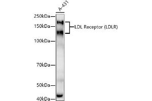 Western blot analysis of extracts of A-431 cells, using LDL Receptor (LDLR) antibody  at 1:1000 dilution. (LDLR anticorps)
