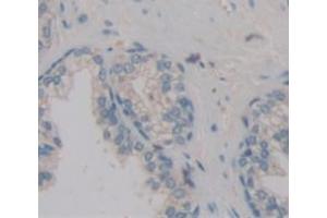 IHC-P analysis of Kidney tissue, with DAB staining. (POTEG anticorps  (AA 177-330))