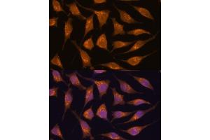 Immunofluorescence analysis of L929 cells using  antibody (ABIN7265416) at dilution of 1:100.