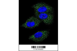 Confocal immunofluorescent analysis of M-CSF Antibody with MDA-MB231 cell followed by Alexa Fluor 488-conjugated goat anti-rabbit lgG (green). (M-CSF/CSF1 anticorps  (AA 230-257))