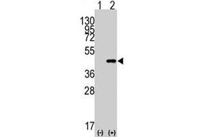 Western blot analysis of CDX2 (arrow) using rabbit CDX2 polyclonal antibody  . (CDX2 anticorps  (N-Term))