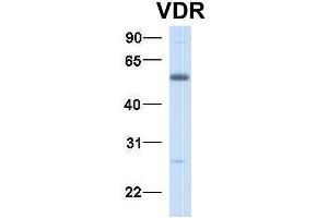 Host:  Rabbit  Target Name:  VDR  Sample Type:  Human Fetal Muscle  Antibody Dilution:  1.