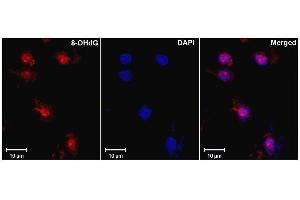 Immunohistochemistry analysis using Mouse Anti-DNA Damage Monoclonal Antibody, Clone 15A3 . (DNA/RNA Damage anticorps (Biotin))