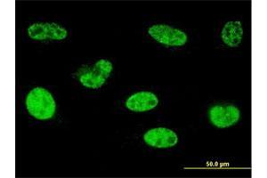 Immunofluorescence of monoclonal antibody to HOXA5 on HeLa cell. (HOXA5 anticorps  (AA 171-270))