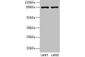 Western blot All lanes: FCHSD2 antibody at 12 μg/mL Lane 1: U251 whole cell lysate Lane 2: A549 whole cell lysate Secondary Goat polyclonal to rabbit IgG at 1/10000 dilution Predicted band size: 85, 78, 59 kDa Observed band size: 85 kDa (FCHSD2 anticorps  (AA 1-290))