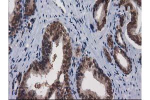 Image no. 12 for anti-Nonhomologous End-Joining Factor 1 (NHEJ1) antibody (ABIN1499728)