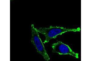 Immunofluorescence analysis of Hela cells using ITGAM mouse mAb (green).