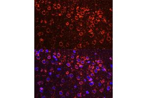 Immunofluorescence analysis of mouse brain using YB-1/YB-1/YBX1 antibody (ABIN6134494, ABIN6150328, ABIN6150330 and ABIN7101815) at dilution of 1:100. (YBX1 anticorps  (AA 100-200))