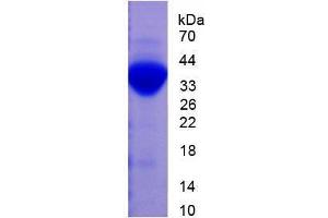 Image no. 1 for Plasminogen (PLG) (AA 191-433) (Active) protein (His tag) (ABIN5665893) (PLG Protein (AA 191-433) (His tag))